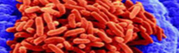 Ученые оживили древнюю бактерию