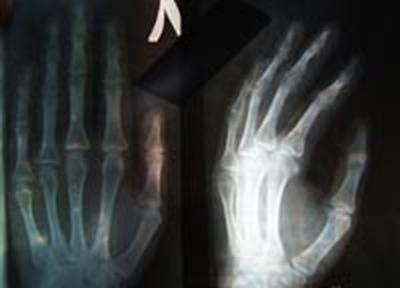 Больницы Владивостока скоро получат новое рентген-оборудование