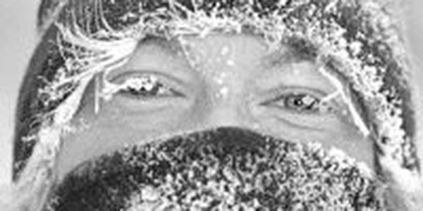 Что можно и нельзя делать при обморожении?