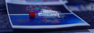 Экспресс-тесты на коронавирус появились в торговой сети Владивостока